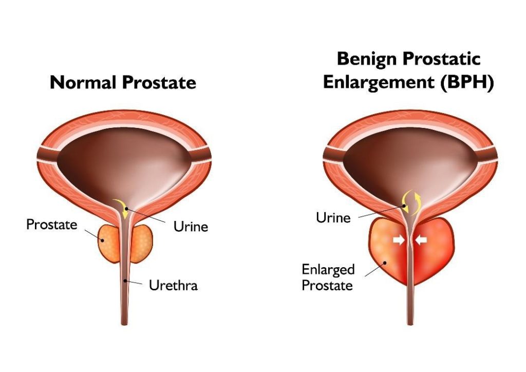 ProstaStream Ingredients