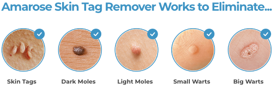 Amarose Skin Tag Remover