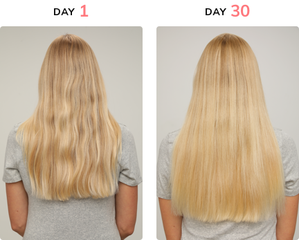 Hair La Vie Before & After Results