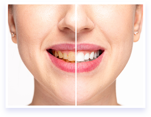Primal Life Organics LED Teeth Whitening System Benefits