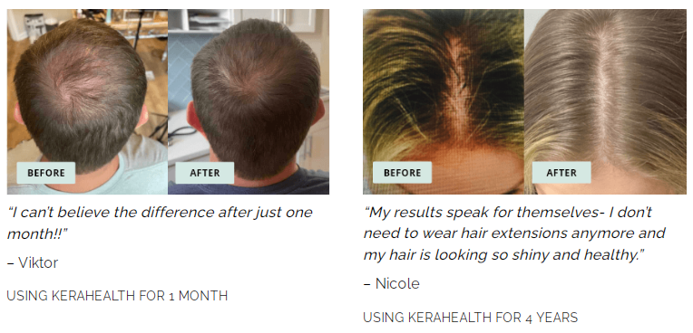 kerahealth hair supplement reviews