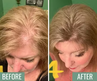 Primal Harvest Hair Growth Complex Before & After Results