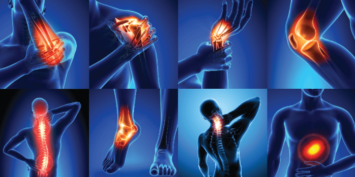 Joint Pain Killer Supplement