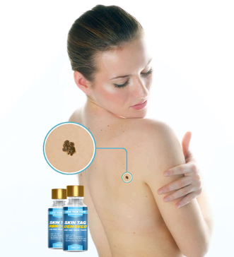 Lose Your Tags Skin Tag Remover Benefits