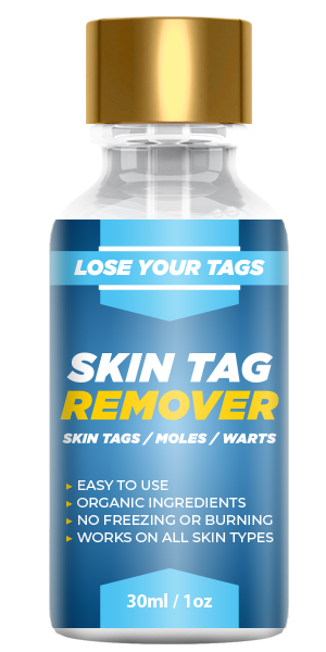 Lose Your Tags Skin Tag Remover Reviews