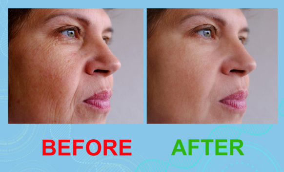 PeakBloom Multi Collagen Beauty Complex Before & After Results